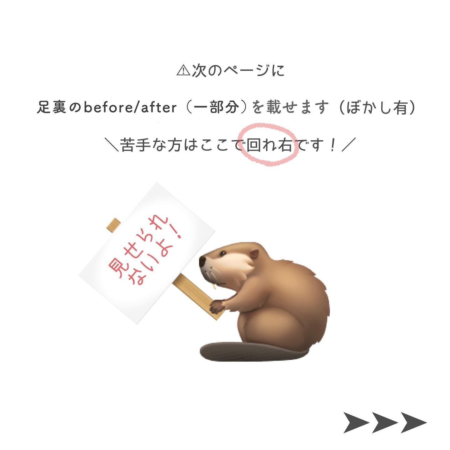 あしやすめ 足裏角質ケアパック/鎌倉ライフ/レッグ・フットケアを使ったクチコミ（3枚目）