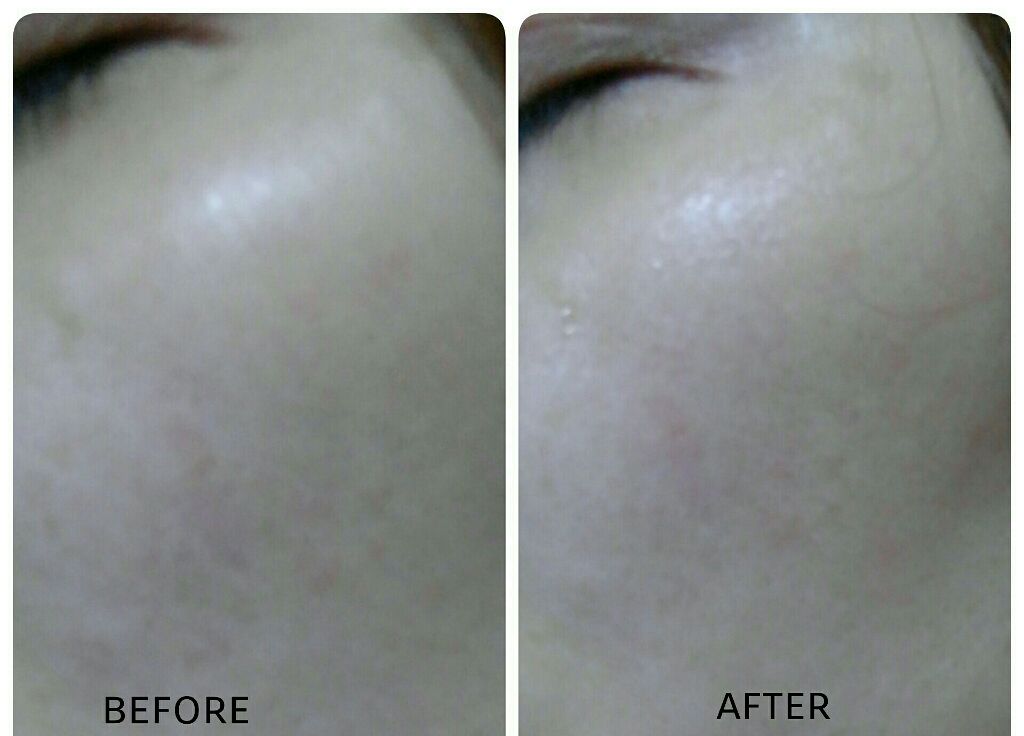 11+1ディザイラス 美容液マスク/11+1 DESIROUS/シートマスク・パックを使ったクチコミ(4枚目)