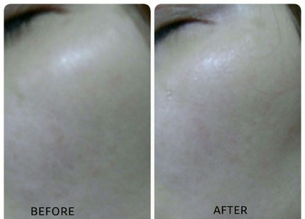 11+1ディザイラス 美容液マスク/11+1 DESIROUS/シートマスク・パックを使ったクチコミ(4枚目)