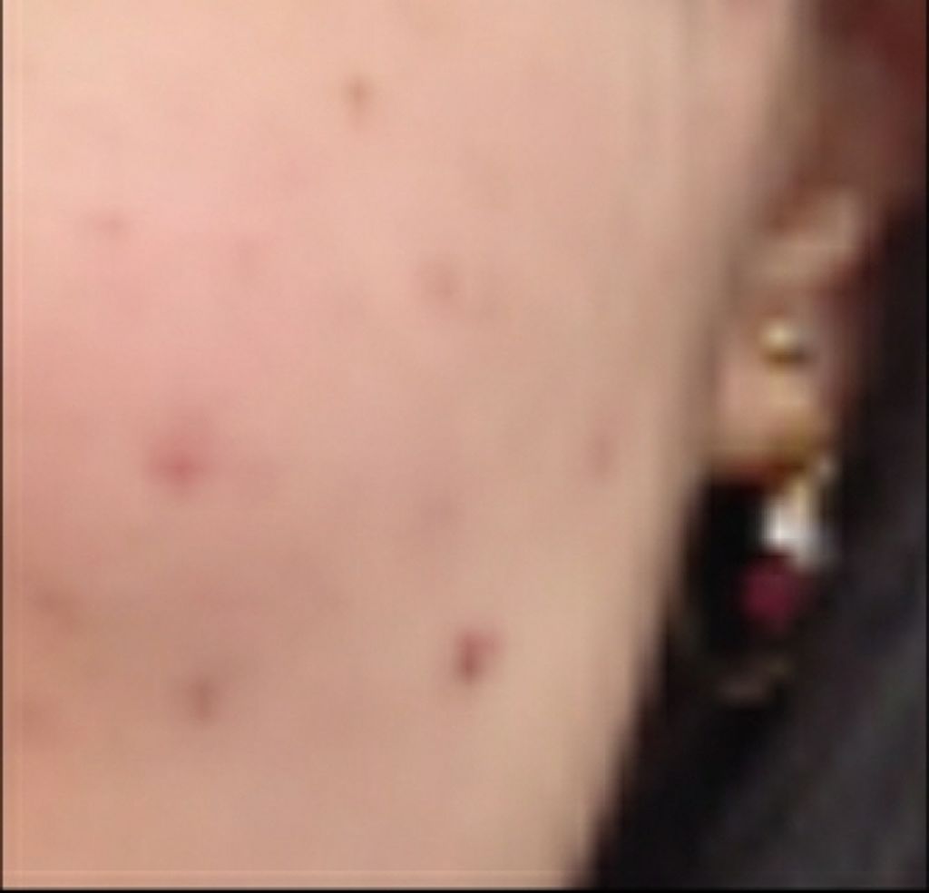 フォーエバー リブレイター エッセンス ローション/YVES SAINT LAURENT BEAUTE/化粧水を使ったクチコミ（1枚目）