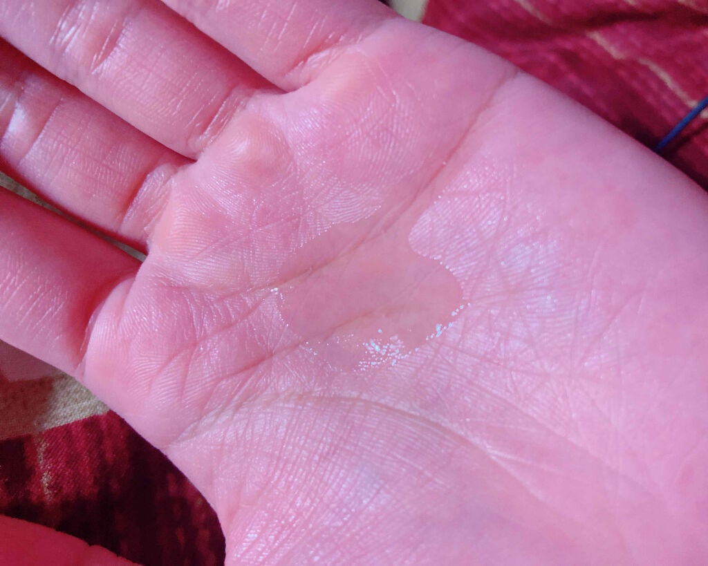 バイオイル/バイオイル/フェイスオイルを使ったクチコミ(3枚目)