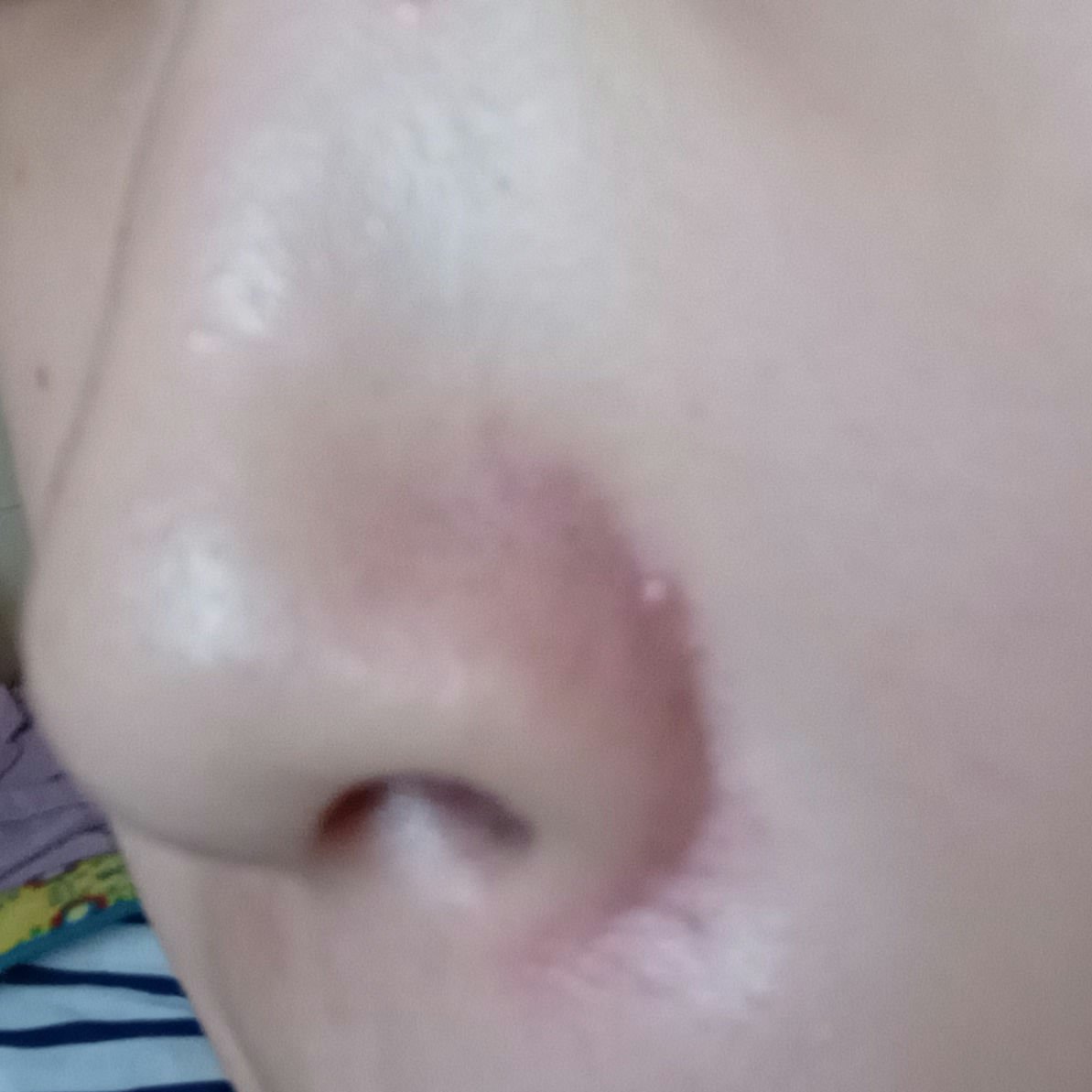 エファクラ ピールケア セラム/ラ ロッシュ ポゼ/美容液を使ったクチコミ（2枚目）