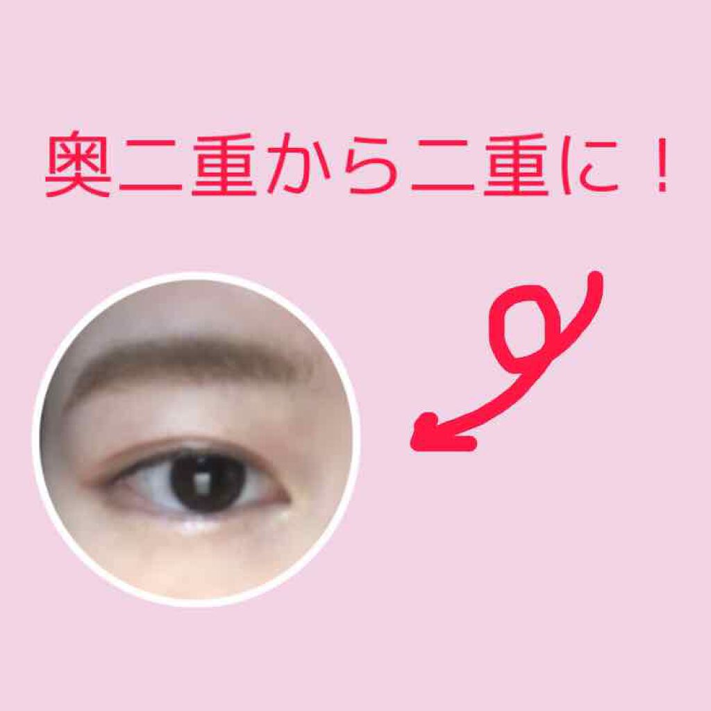 アクティブアイトークII/アイトーク/二重まぶた用アイテムを使ったクチコミ(1枚目)