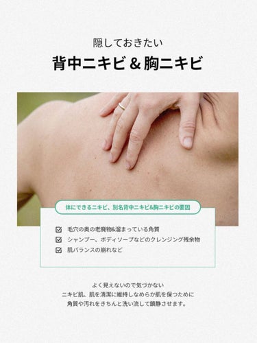 SKINRx LAB マデセラニキビクリアリングボディウォッシュのクチコミ「【使った商品】
SKINRx LAB [背中にきび/胸にきび]マデセラニキビクリア リングボデ.....」（1枚目）