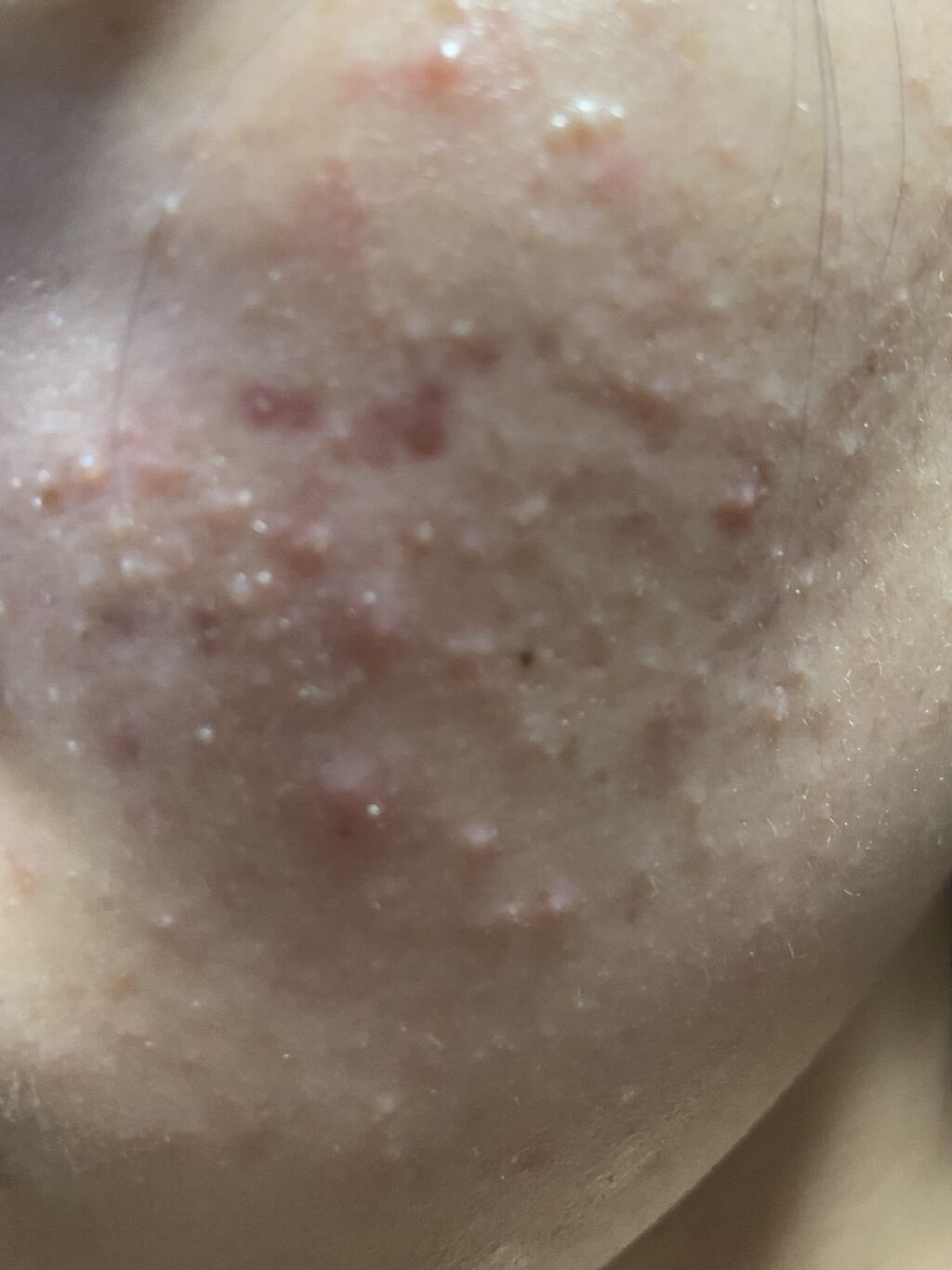 白潤プレミアム 薬用浸透美白乳液/肌ラボ/乳液を使ったクチコミ（2枚目）