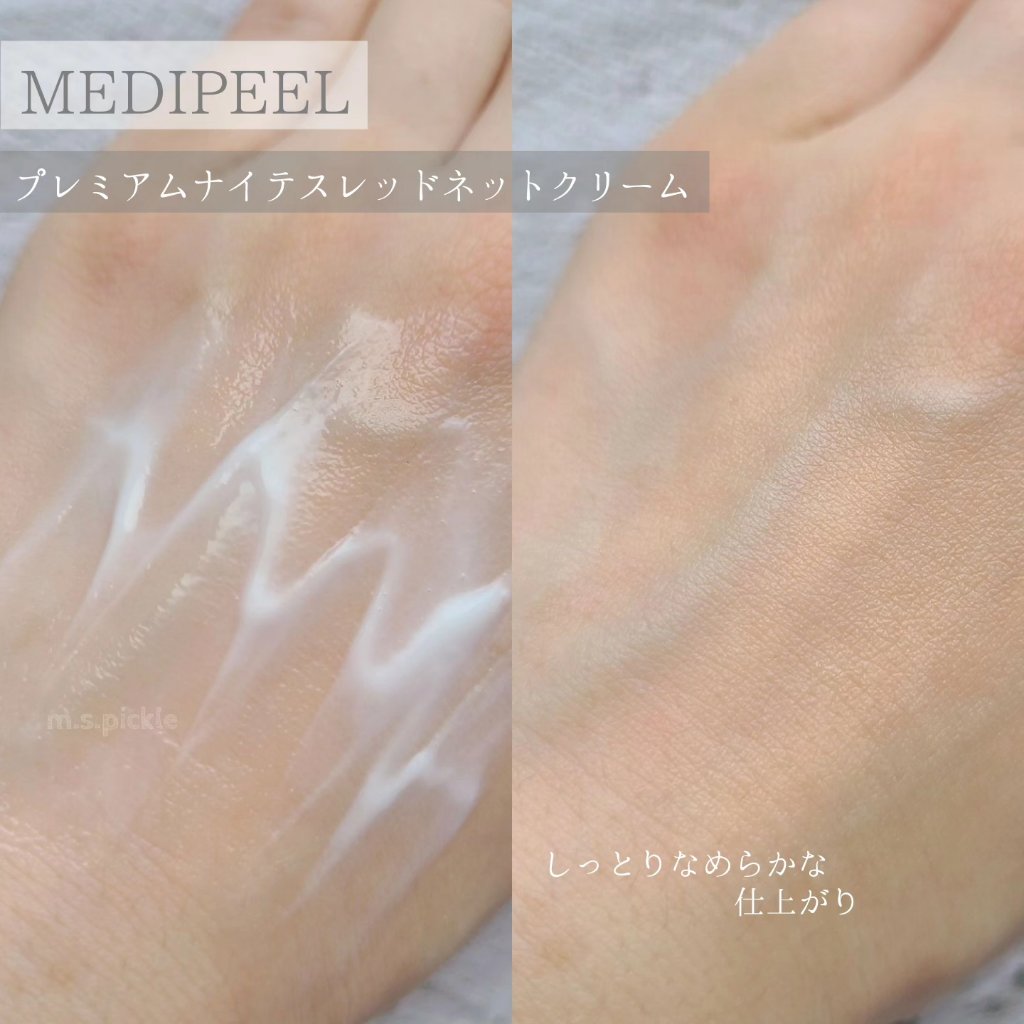 プレミアムナイテ スレッドネッククリーム/MEDIPEEL/ネック・デコルテケアを使ったクチコミ（2枚目）