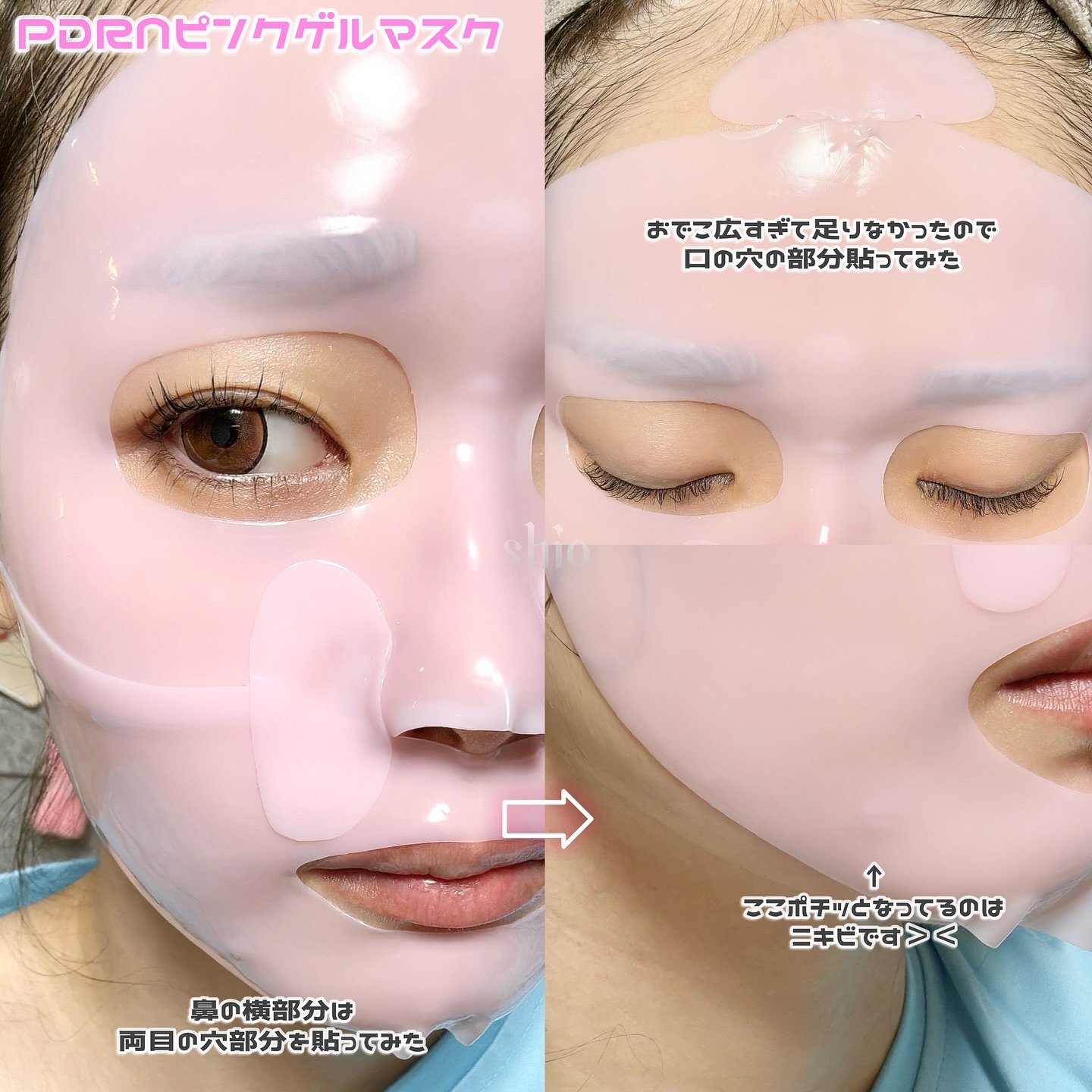 MEDICUBEのスキンケア・基礎化粧品 PDRNピンクコラーゲンゲルマスク他