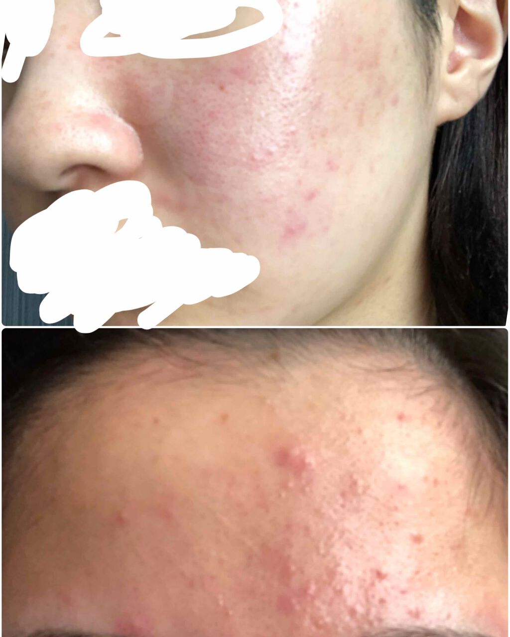 ハトムギ化粧水(ナチュリエ スキンコンディショナー R )/ナチュリエ/化粧水を使ったクチコミ（2枚目）