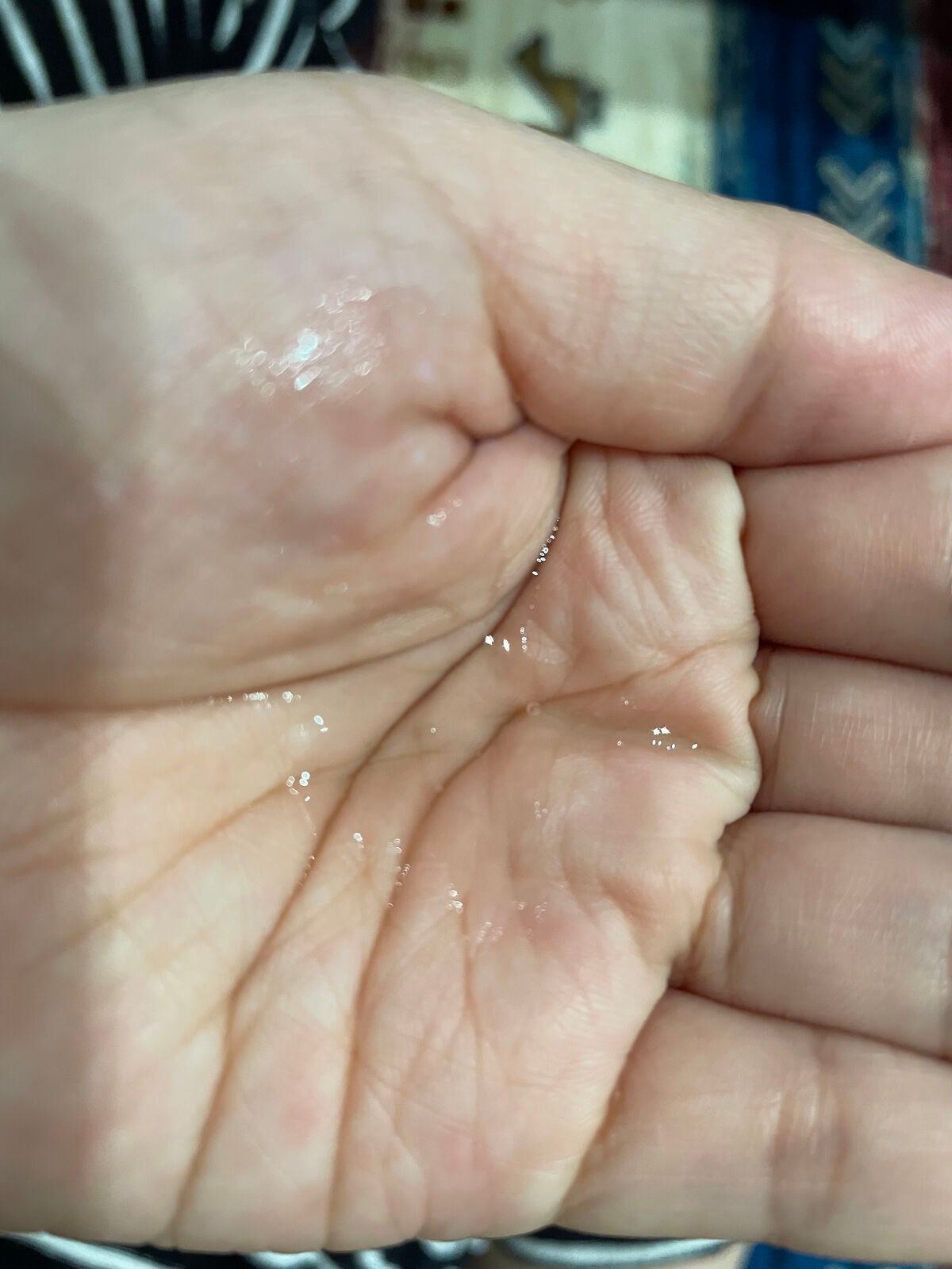 エッセンシャル トリートメントローション/ロベクチン/化粧水を使ったクチコミ(2枚目)