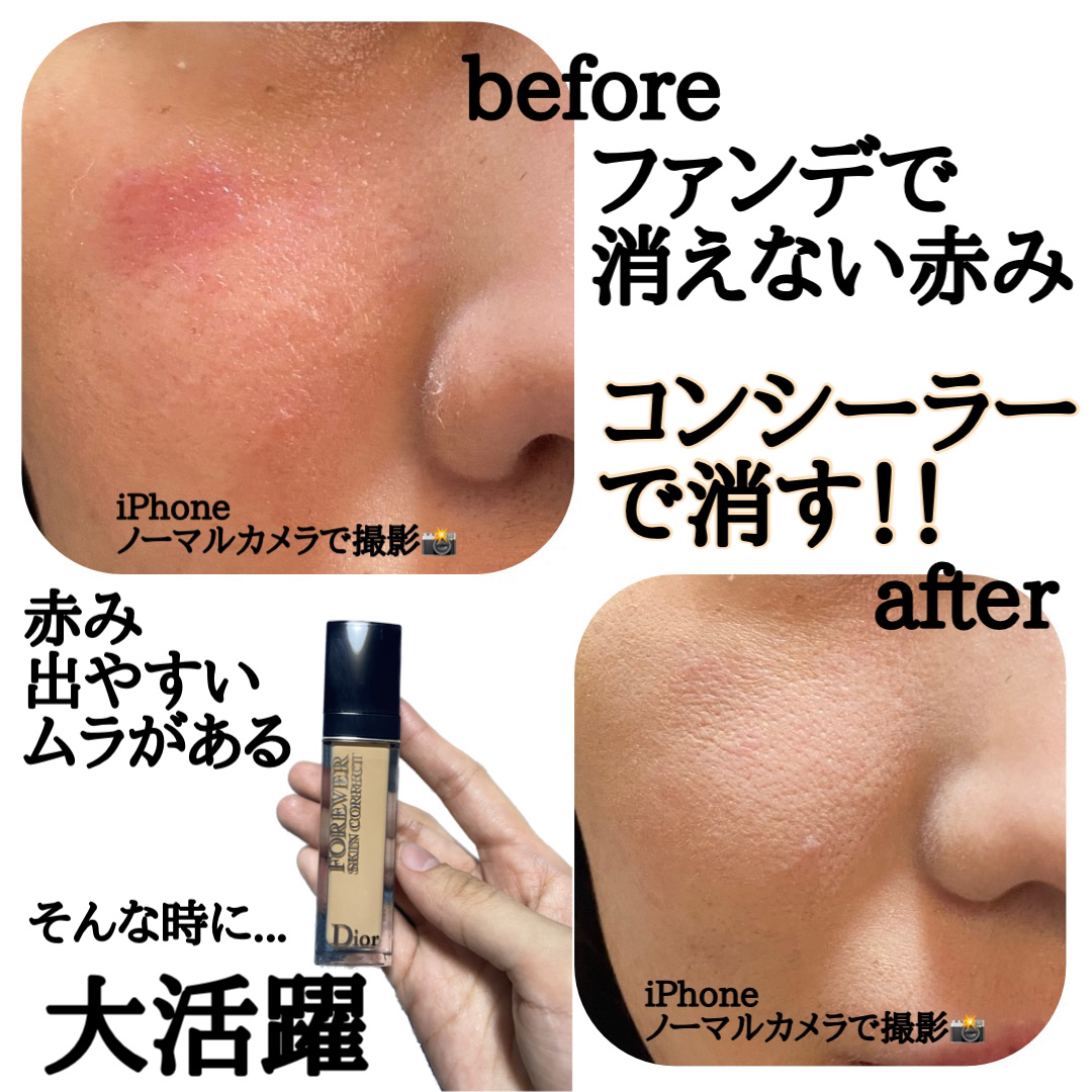 ディオールスキン フォーエヴァー スキン コレクト コンシーラー/Dior/リキッドコンシーラーを使ったクチコミ（1枚目）