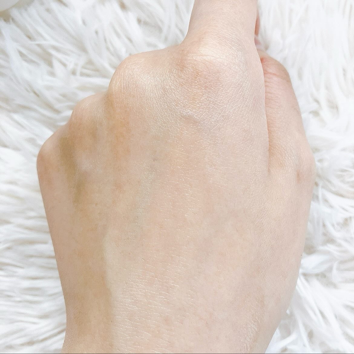 ビディ ニードルエッセンス GG/ビディ/美容液を使ったクチコミ(6枚目)