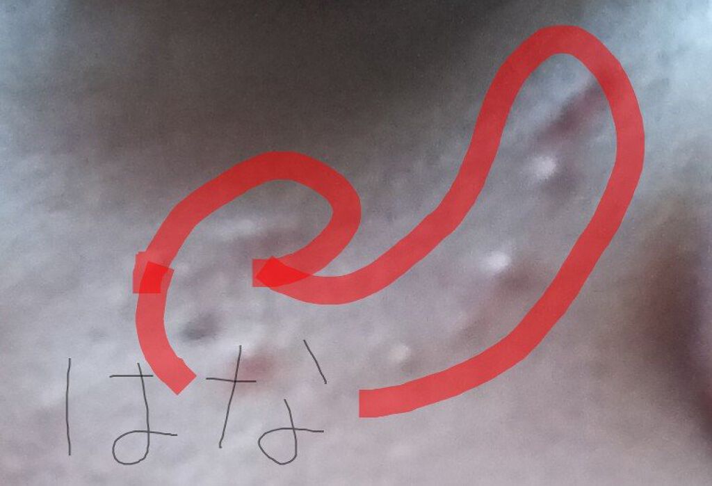 オロナインＨ軟膏 (医薬品)/オロナイン/その他を使ったクチコミ（3枚目）