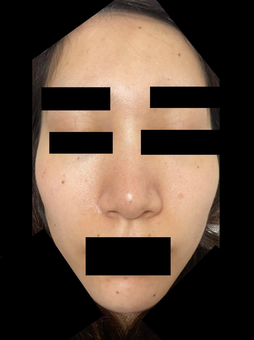 ブスならせめて美肌になりたい on LIPS 「久しぶりの投稿。もっと肌白くなりたいな、、..」(1枚目)