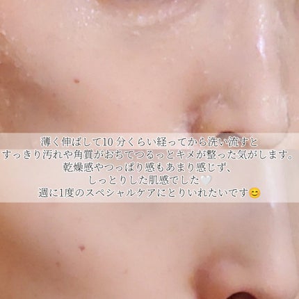 RICE MASK/I'm from/洗い流すパック・マスクを使ったクチコミ(8枚目)