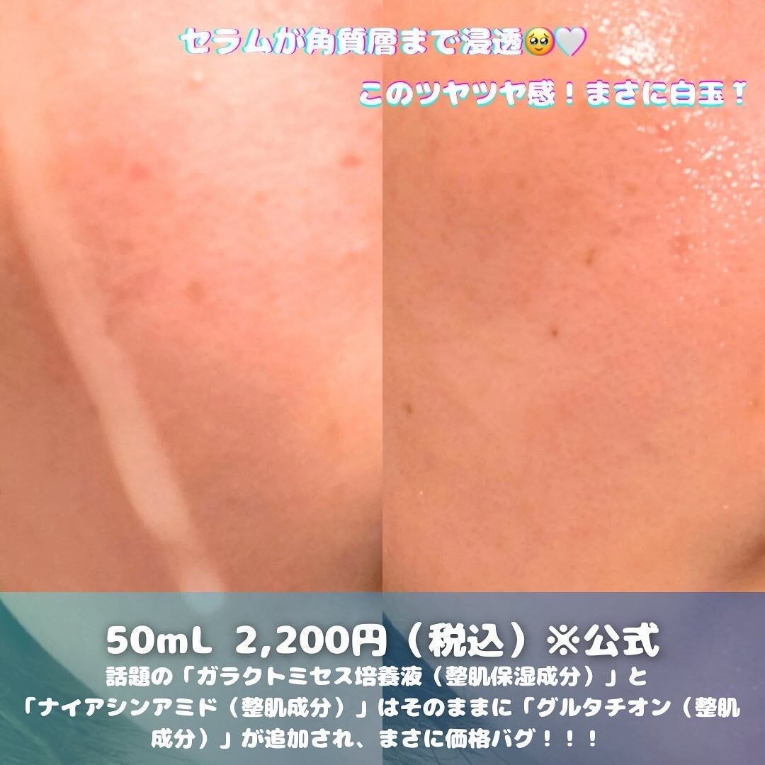 クリアエッセンス セラム/ピュレア/美容液を使ったクチコミ(2枚目)