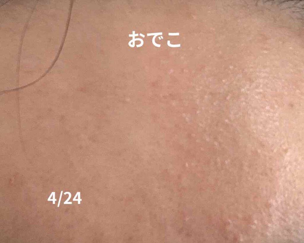 薬用 しみ 集中対策 美容液/メラノCC/美容液を使ったクチコミ(3枚目)