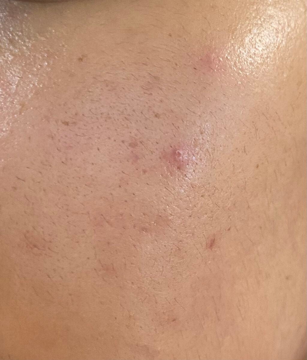 rsl on LIPS 「美容院または皮膚科で何やって貰ってば良いのでしょうか?宜しくお..」(2枚目)