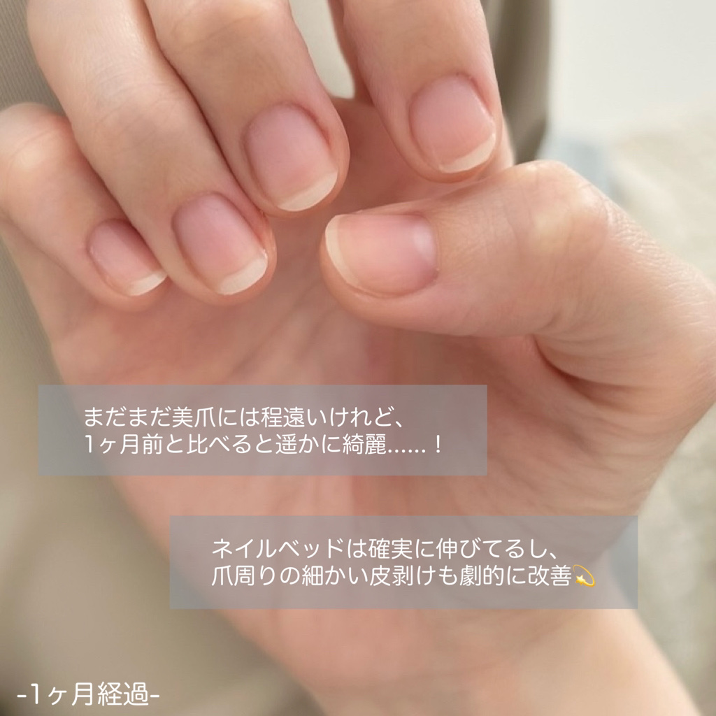 甘皮ケアオイル/無印良品/ネイルオイル・トリートメントを使ったクチコミ（3枚目）