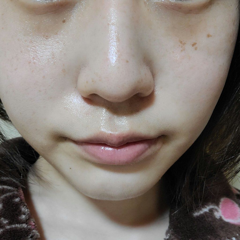 RMK Wトリートメントオイル/RMK/ブースター・導入液を使ったクチコミ（2枚目）