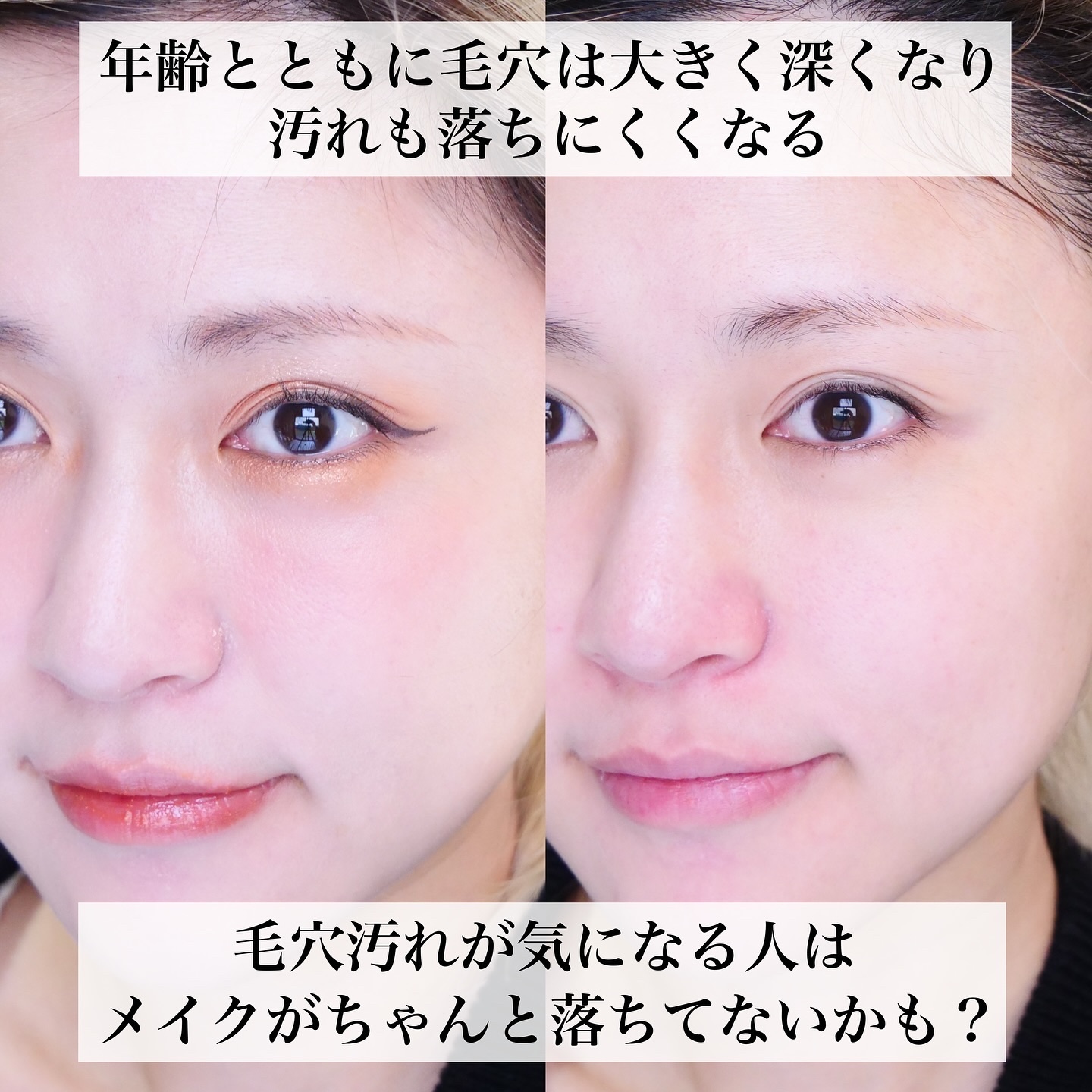 DHC ディープ クレンジング バーム/DHC/クレンジングバームを使ったクチコミ（2枚目）