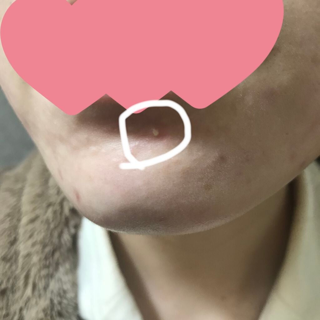 ビオオイル アルガンオイル/Melvita/フェイスオイルを使ったクチコミ(3枚目)