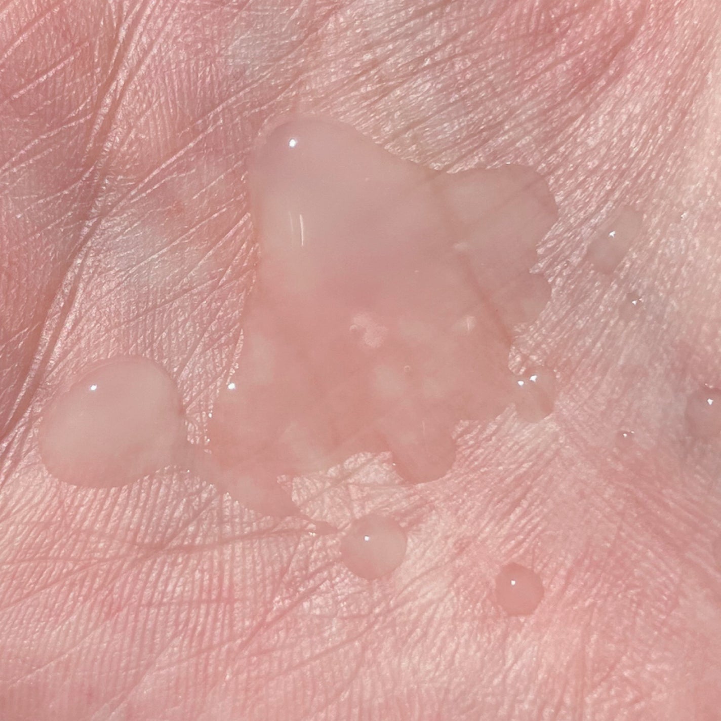 モイスチャー サージ ハイドレーティング ローション/CLINIQUE/化粧水を使ったクチコミ(2枚目)