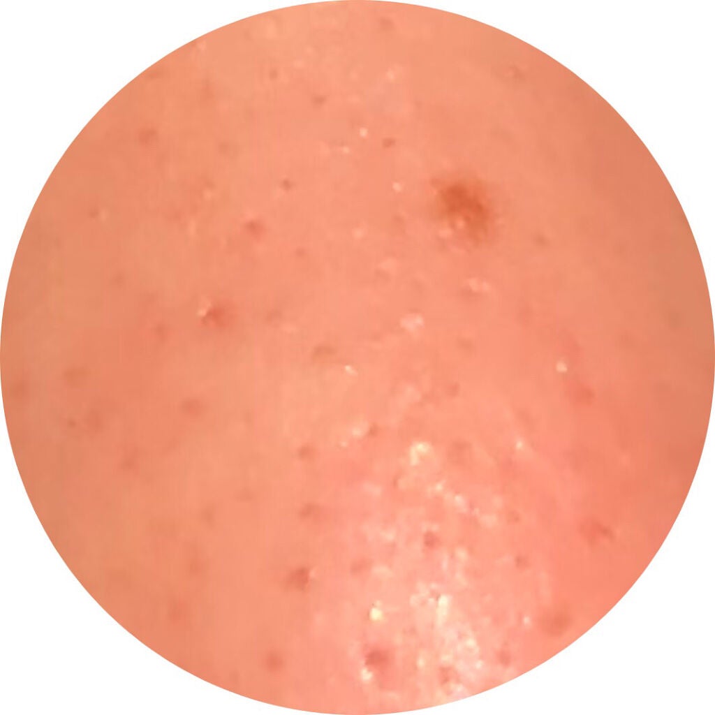 DETクリア ブライト&ピール ピーリングジェリー 炭/Detclear/ピーリングを使ったクチコミ(5枚目)