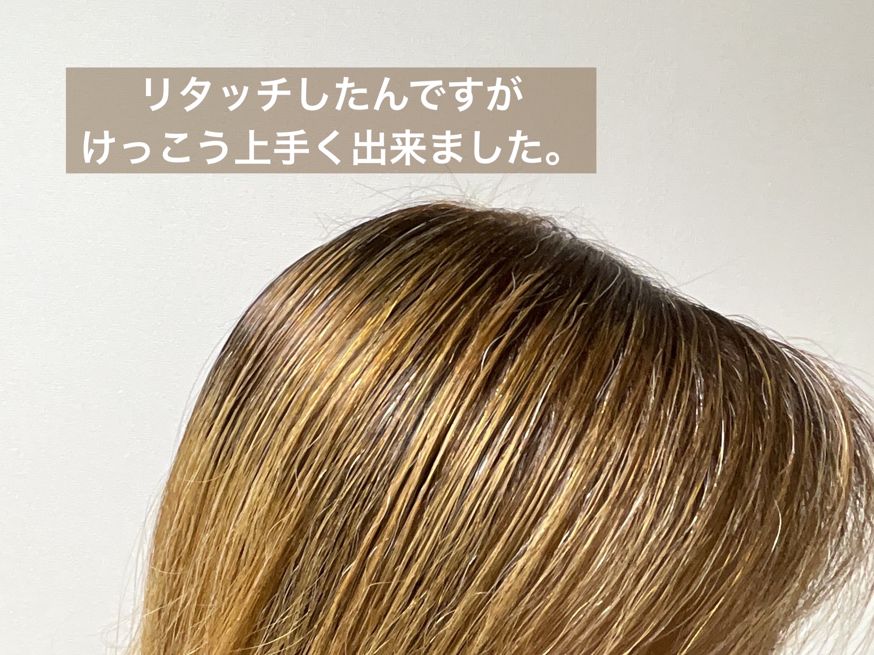 ベースアップブリーチ/ビューティーン/ブリーチ剤を使ったクチコミ（2枚目）