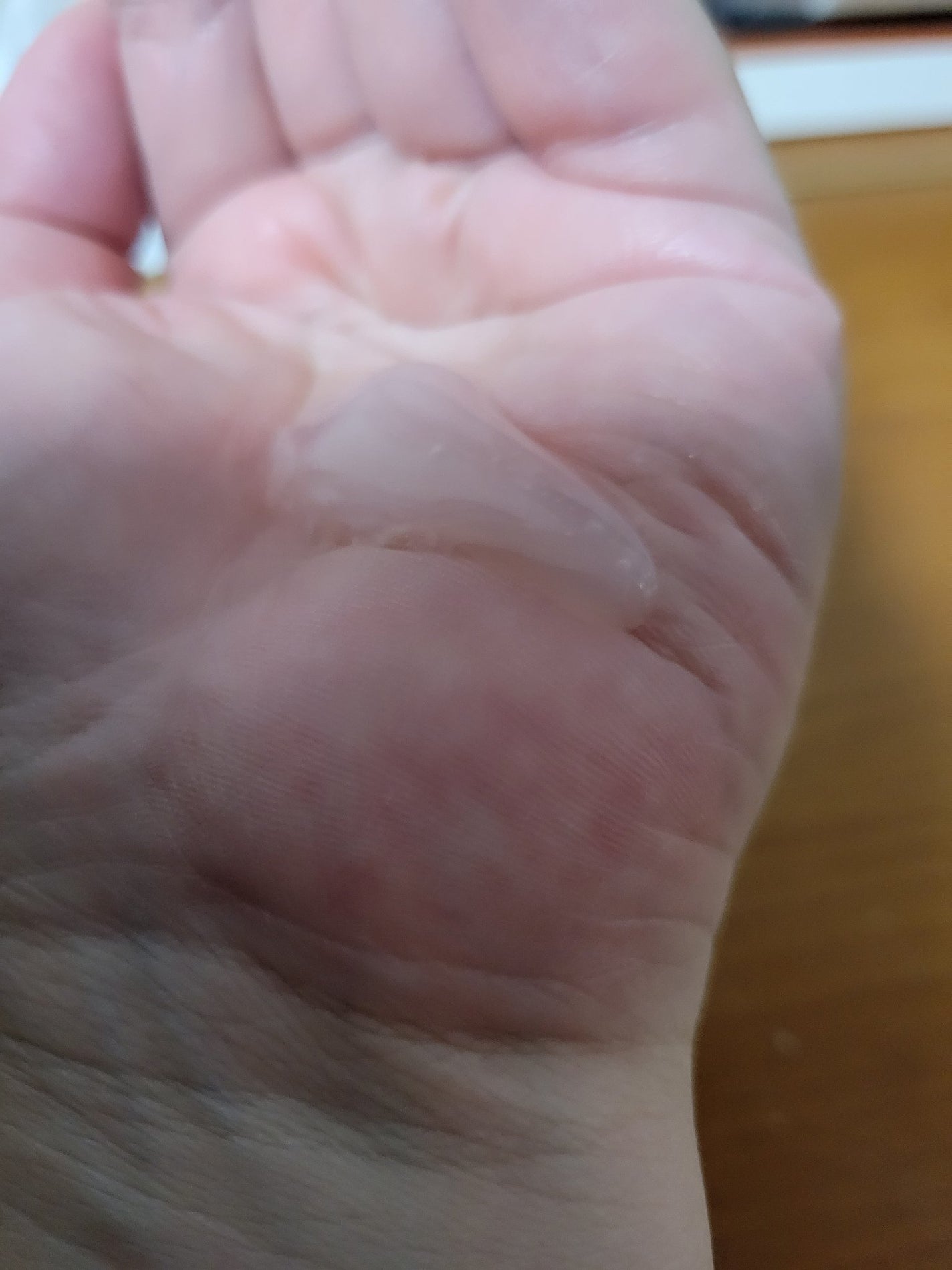 ディープ プレ モイストエッセンス/フリープラス/ブースター・導入液を使ったクチコミ(3枚目)