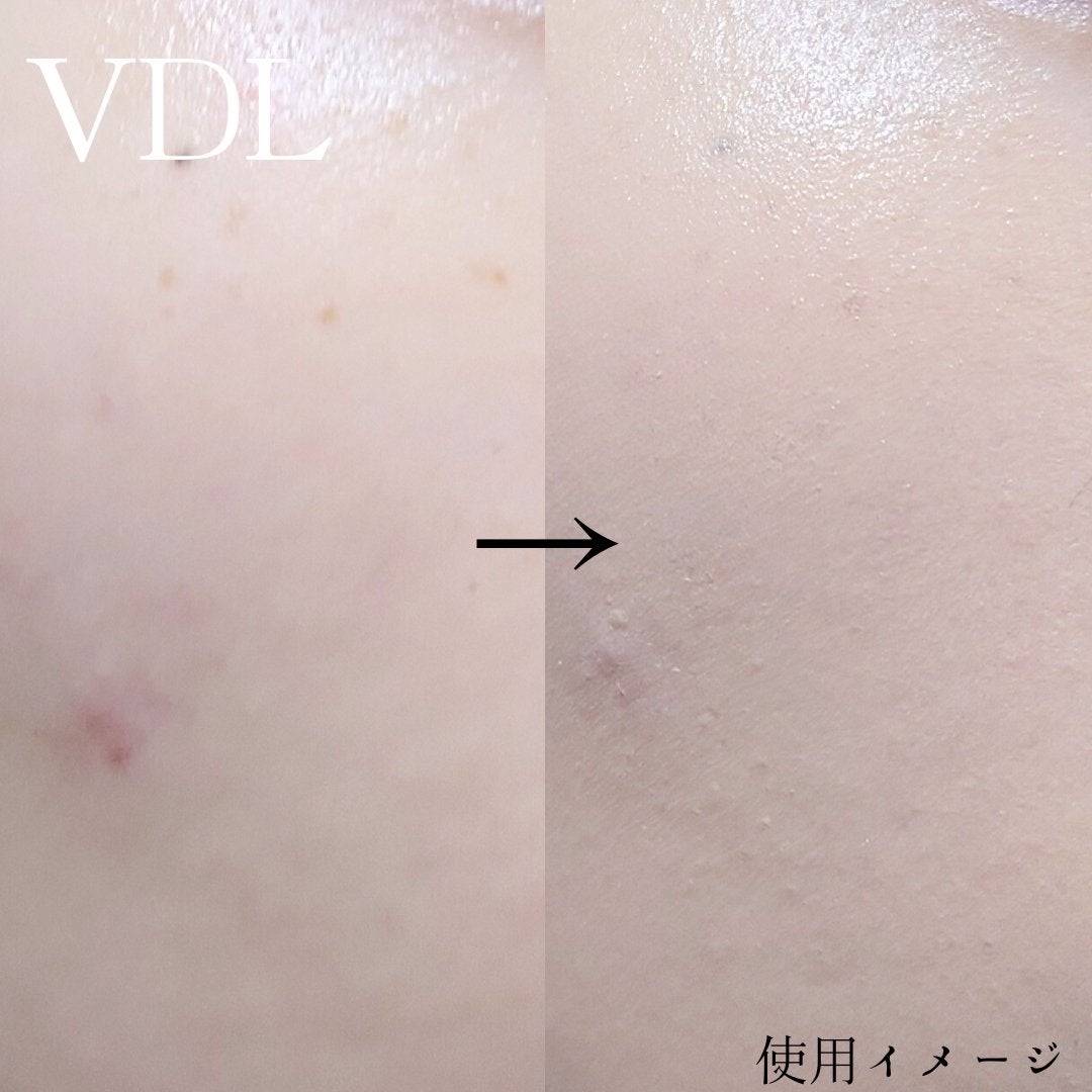 カバーステイン パーフェクティング ファンデーション/VDL/リキッドファンデーションを使ったクチコミ(4枚目)