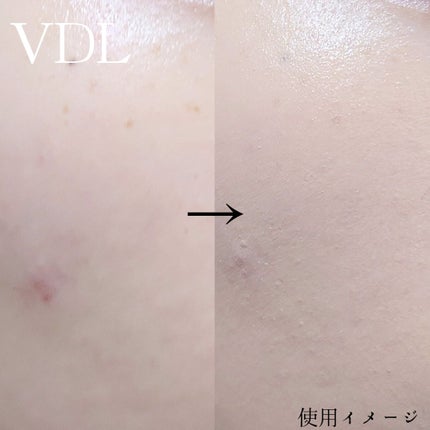 カバーステイン パーフェクティング ファンデーション/VDL/リキッドファンデーションを使ったクチコミ(4枚目)