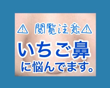 ⚠️閲覧注意⚠️
“めっちゃ酸化して黒ずんでるいる私の毛穴事情”


💧🥶💍🧢🦋🐳☃️🧊🥏💙


こんにちわ青ちゃんです💙
こう見えて初投稿させて頂いてます(?)

青ちゃんでは、毛穴汚れ日記的なんをや