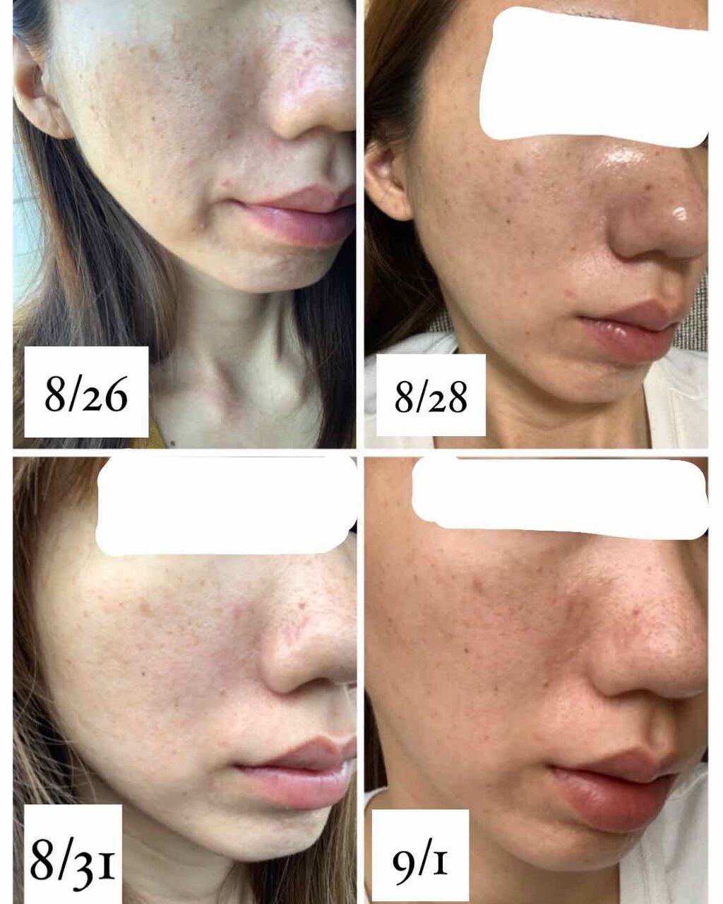 ハトムギ保湿ジェル(ナチュリエ スキンコンディショニングジェル)/ナチュリエ/美容液を使ったクチコミ（2枚目）