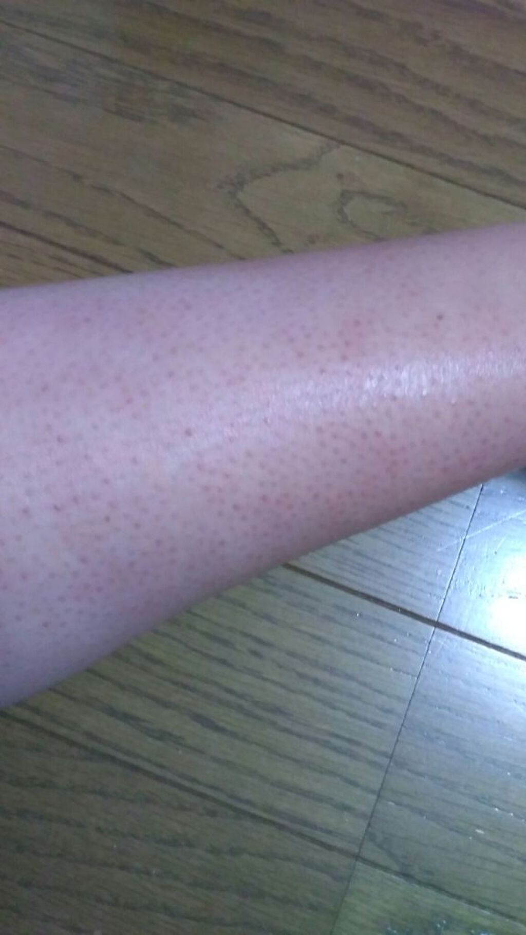 ハトムギ化粧水(ナチュリエ スキンコンディショナー R )/ナチュリエ/化粧水を使ったクチコミ(3枚目)