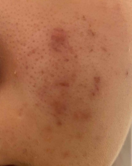 ã²ããð¥ on LIPS ãå©ããŠãã ããâŠèªç²äžããã¡ã³ããŒã·ã§ã³ãªã©ããªãããå°ãã¯è..ãïŒ3æç®ïŒ