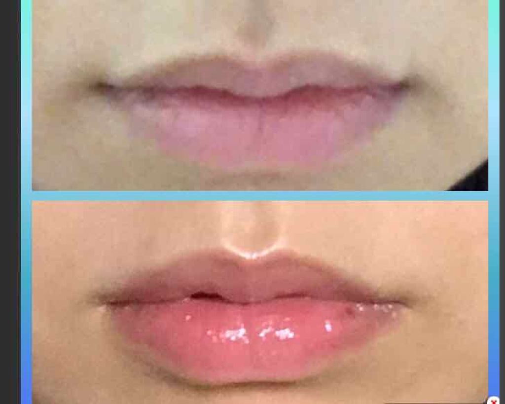 モイストピュアカラーリップ/ニベア/リップクリームを使ったクチコミ（1枚目）