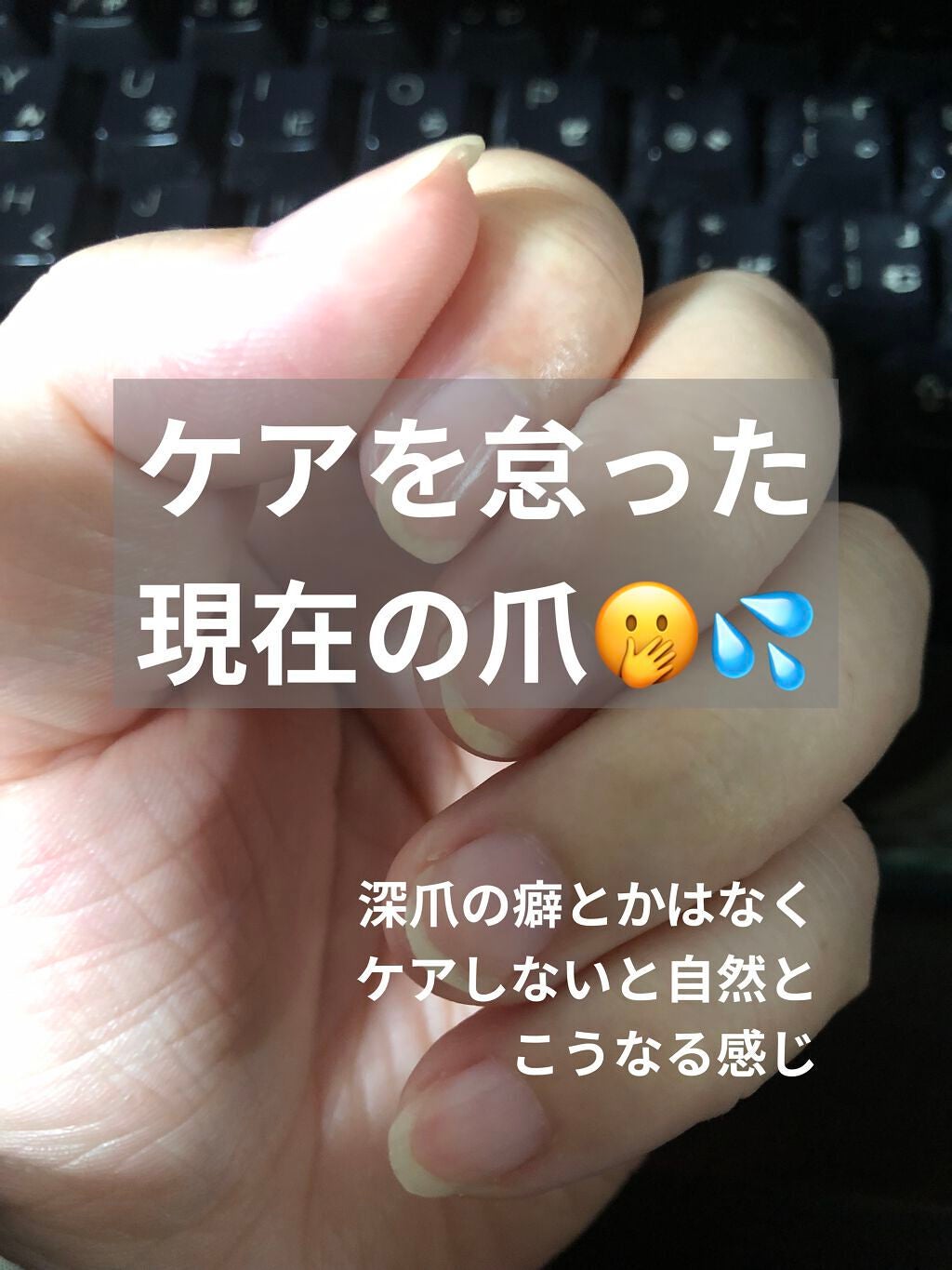 デイケアオイル/Dr.Nail/ネイルオイル・トリートメントを使ったクチコミ(2枚目)