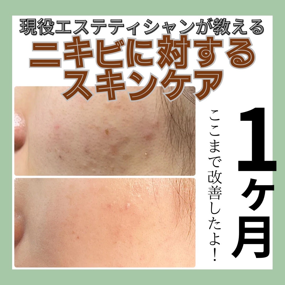 潤浸保湿 フェイスクリーム/キュレル/フェイスクリームを使ったクチコミ(1枚目)