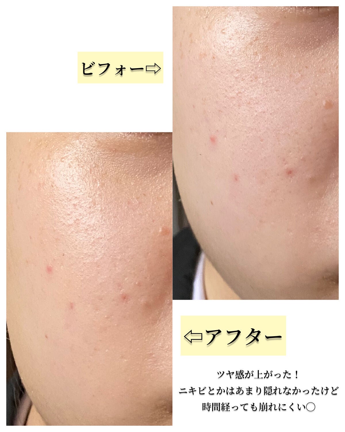 RMK リクイドファンデーション フローレスカバレッジ/RMK/リキッドファンデーションを使ったクチコミ(5枚目)