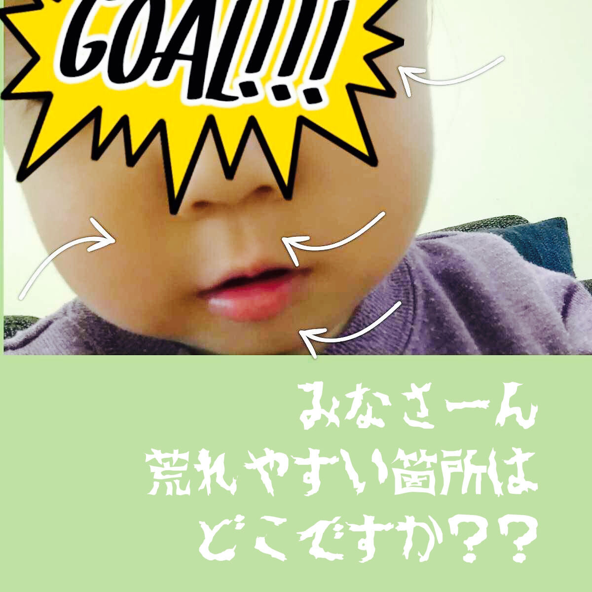 マデカクリーム/センテリアン24/フェイスクリームを使ったクチコミ（1枚目）