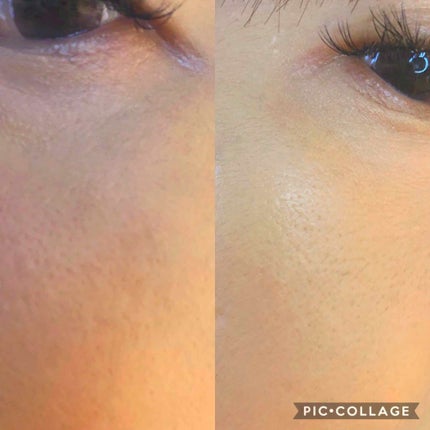 ナチュラルラディアント ロングウェア クッションファンデーション/NARS/クッションファンデーションを使ったクチコミ(3枚目)