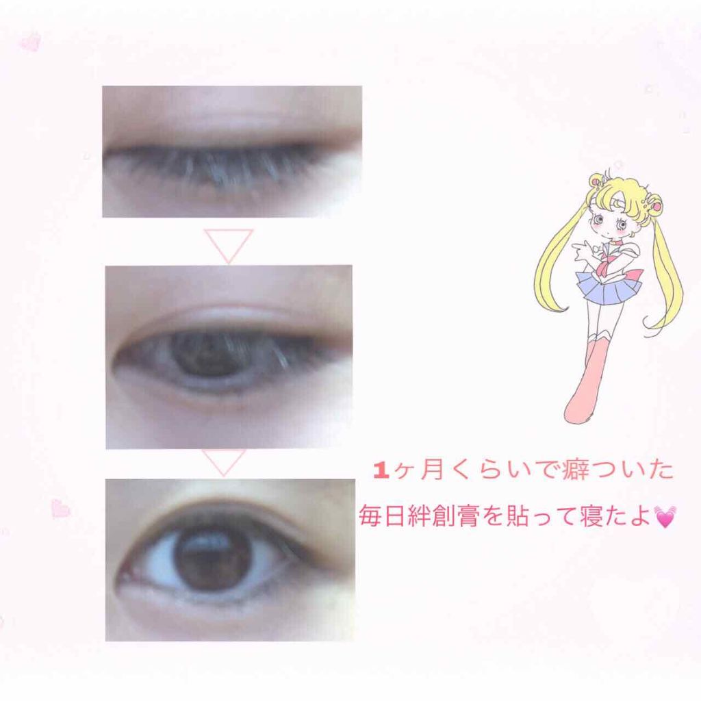 のびーるアイテープ（絆創膏タイプ、レギュラー）/DAISO/二重まぶた用アイテムを使ったクチコミ（2枚目）