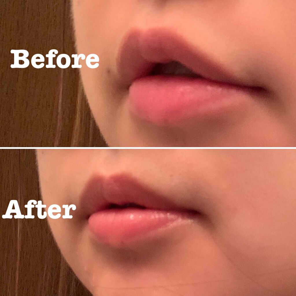 カラーリップスティック/アルジェラン/リップクリームを使ったクチコミ(1枚目)