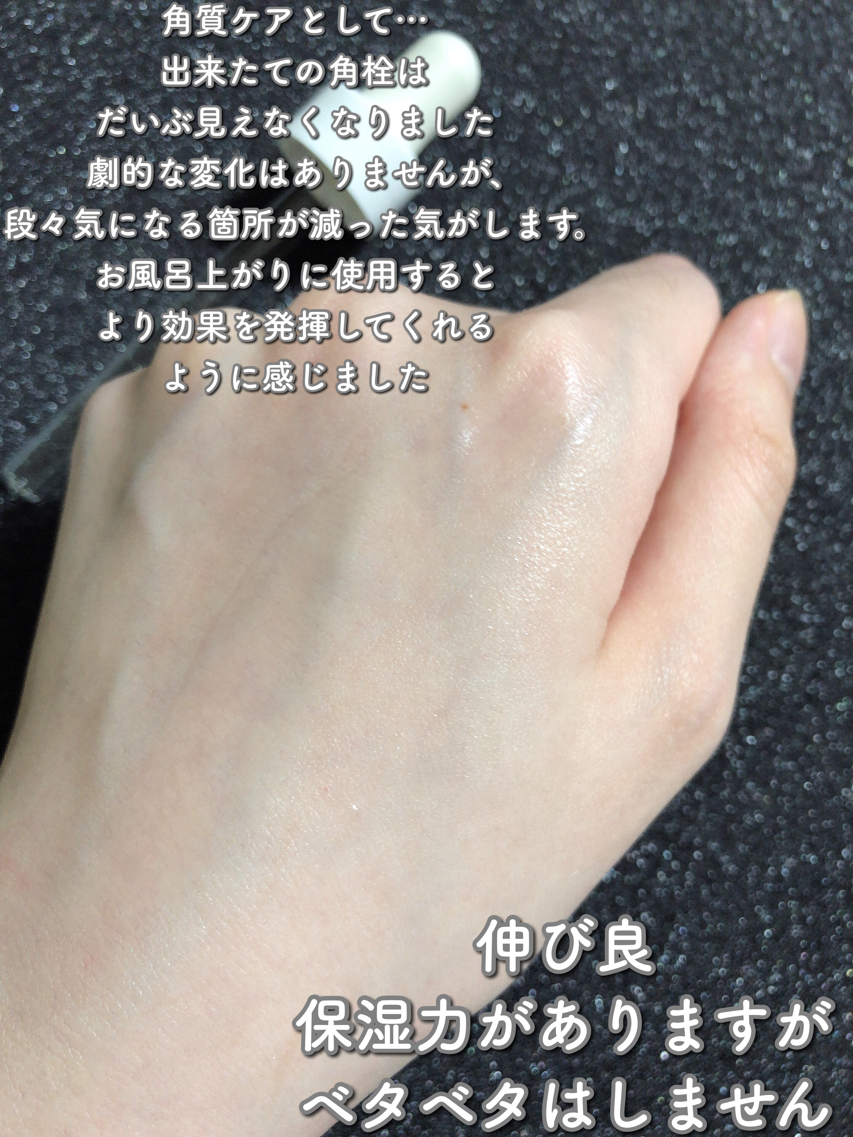 エファクラ ピールケア セラム/ラ ロッシュ ポゼ/美容液を使ったクチコミ（3枚目）