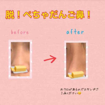 ノーズトレーナー/DAISO/その他スキンケアグッズを使ったクチコミ(1枚目)