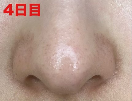 ディープクリア酵素洗顔 /メラノCC/洗顔フォームを使ったクチコミ(6枚目)