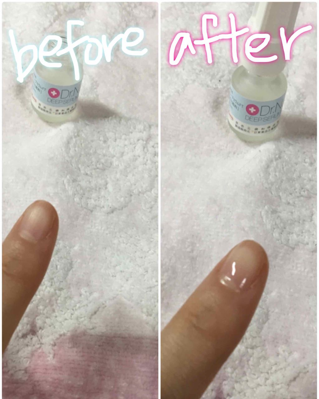 ディープセラム/Dr.Nail/ネイルオイル・トリートメントを使ったクチコミ(3枚目)