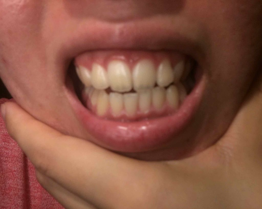 HITEETH ALL IN ONE MOUTH GEL/R&/歯磨き粉を使ったクチコミ（3枚目）