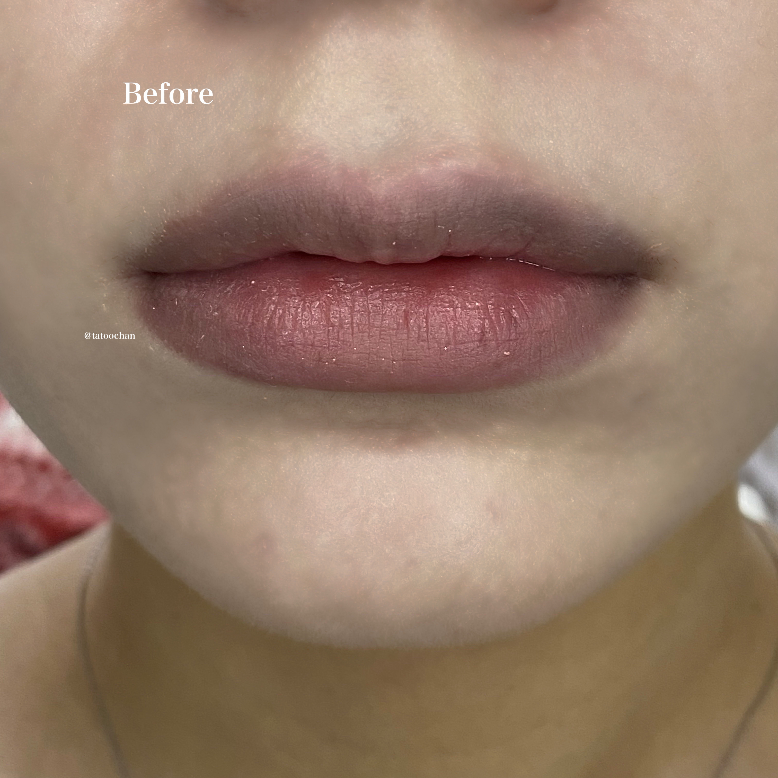 ドトムリッププラスプランパー/keybo/リッププランパーを使ったクチコミ（3枚目）