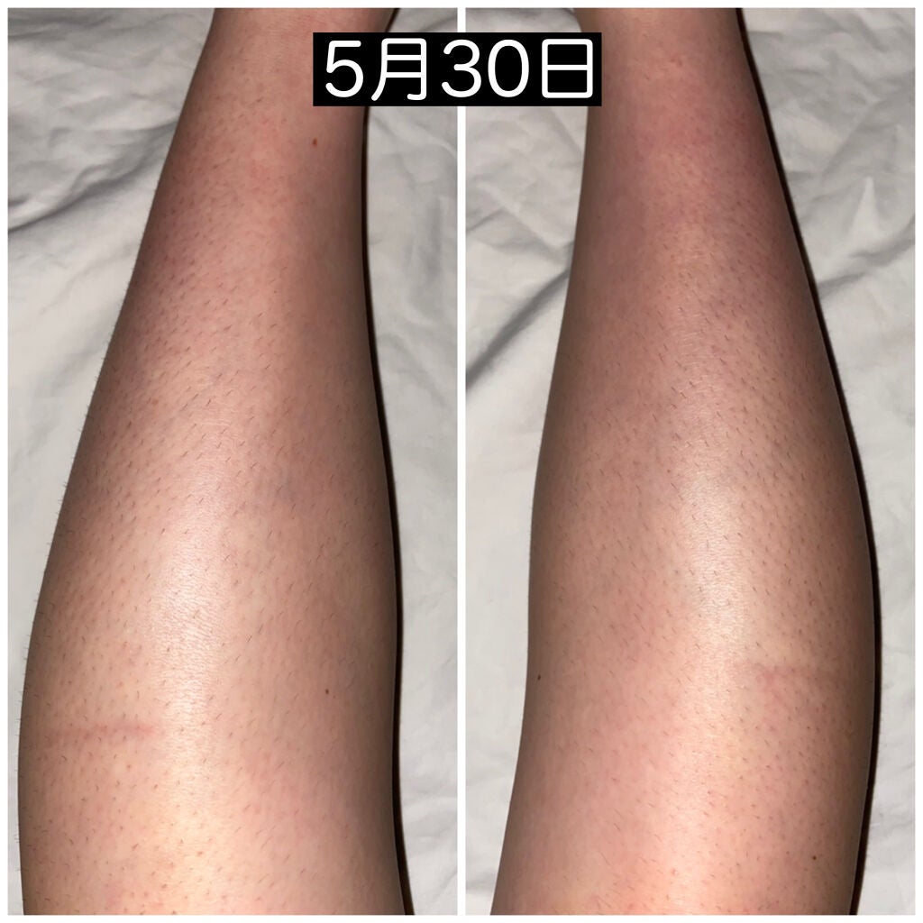 マイルド&モイスチャーアロエジェル/ネイチャーリパブリック/ボディローションを使ったクチコミ(3枚目)